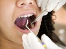 Ağız ve Diş Sağlığı - Diş Çekimi